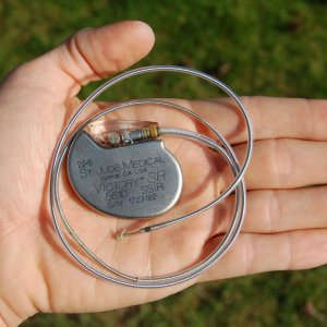 Pacemaker difettosi, allerta anche in Italia