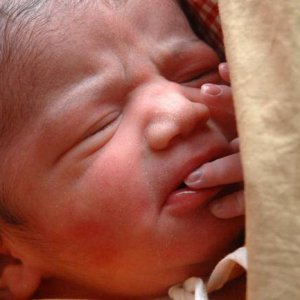 Spesso i neonati piangono a lungo perché soffrono di coliche, può aiutare l'agopuntura