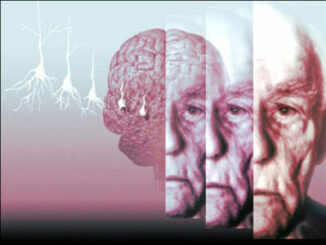 Nella malattia di Alzheimer, la proteina tau avanza sfruttando il nostro "punto di forza": la connettività cerebrale.