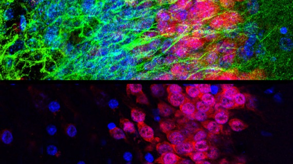 Nuove cellule cerebrali in un cervello di neonato (in verde nella foto in alto). Non sono presenti nel tessuto cerebrale di un 35enne (in basso). | KEN PROBST VIA SCIENCE