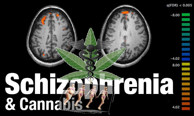 L'uso di marjuana come cura contro la schizofrenia