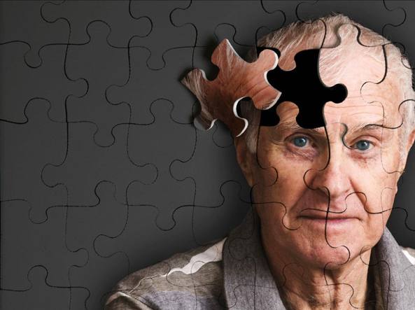 Nuovo metodo di diagnosi precoce dell'Alzheimer