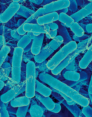 Bacteroides. I batteri di questo genere dominano nelle pance degli occidentali. Si pensa siano legati alla dieta ricca di zuccheri e grassi, o più che altro povera di fibre.
