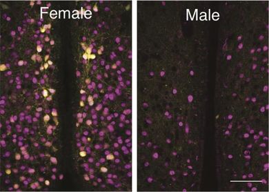 Confronto tra maschi e femmine nelle cellule cerebrali sensibili all'ossitocina (Ryoichi Teruyama, LSU)