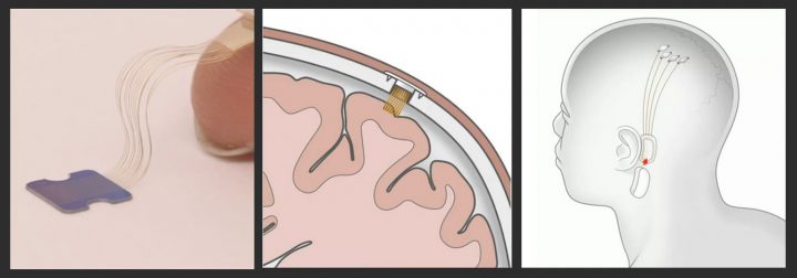 A sinistra: i fili connettori e il sensore che verrà posizionato sul cranio. Al centro e a destra: una rappresentazione di come saranno i collegamenti.