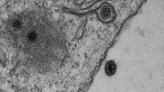 Virioni di Yaravirus (le macchie più scure nella foto al microscopio) infettano un'ameba. | J. Abrahão e B. La Scola/IHU-Marseille/Microscopy Center UFMG-Belo Horizonte