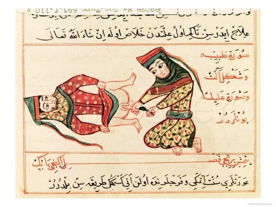 L'operazione della castrazione in una miniatura del 1466. |