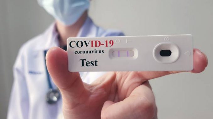 Arriverà un test anticorpale affidabile per coronavirus ?