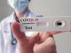 Arriverà un test anticorpale affidabile per coronavirus ?