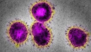 Fotografia al microscopio elettronico di particelle del virus responsabile della SARS (© SPL/AGF)