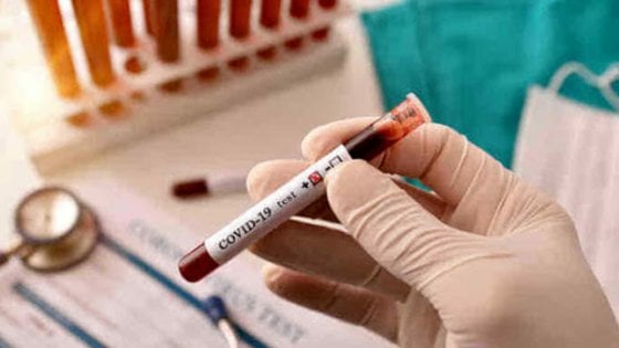 Studio sugli anticorpi degli animali per curare il coronavirus Studio sugli anticorpi degli animali per curare il coronavirus