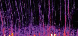 Microfotografia di neuroni optogenetici (©Riccardo/Beltramo/IIT) 