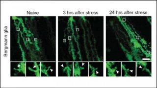 Così lo stress altera il cervello