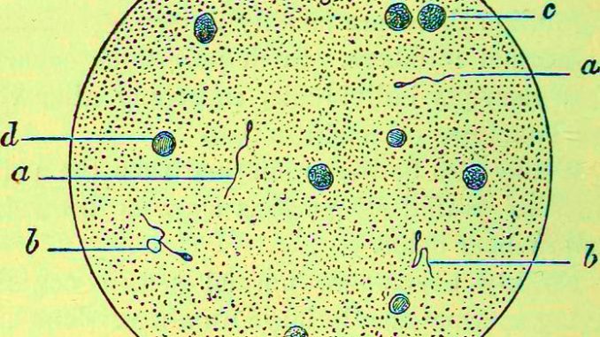 Azoospermia, creati spermatogoni in provetta