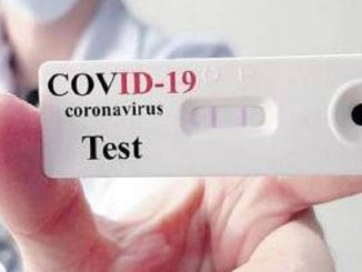 Distinguere fra test sierologico e test molecolare per il covid-19