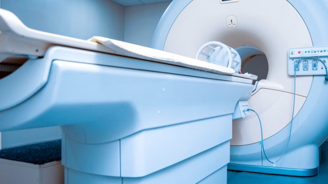Scansione MRI del cervello per la cura di autismo e alzheimer
