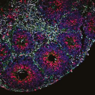 Una cellula di un organoide cerebrale