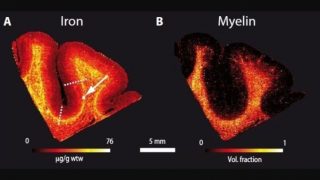 I ricercatori hanno creato una mappa a risoluzione altissimadella materia bianca superficiale del cervello (credito: MPI CBS)