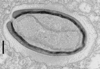 Un virus gigante, un Pandoravirus quercus, al microscopio elettronico: la barra della scala corrisponde a 100 nm (nm, nanometro: milionesimo di millimetro). | IGS- CNRS/AMU