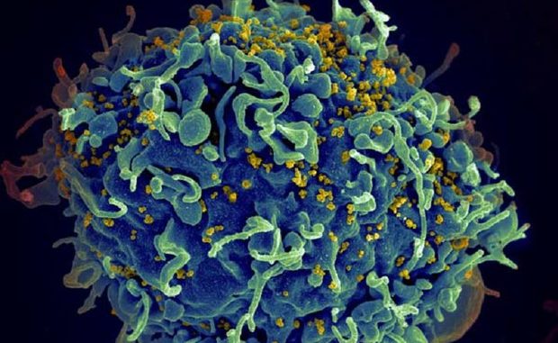 Una cellula umana attaccata dal virus Hiv (fonte: S. Pincus, E. Fischer, A. Athman, NIAID/NIH) © ANSA/Ansa