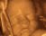 Una visione straordinaria nel grembo materno la consente l'ecografia 4D che visualizza l'immagine tridimensionale in movimento e in tempo reale: si vede così il feto che muove le manine, si succhia il dito o gioca con il cordone ombelicale. La visione migliore è possibile dopo la venticinquesima settimana, quando il feto è di medie dimensioni.