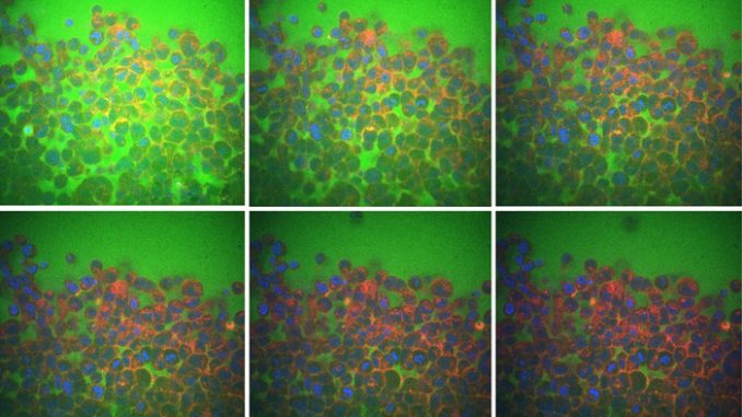 In verde il fluido che scorre negli spazi fra le cellule